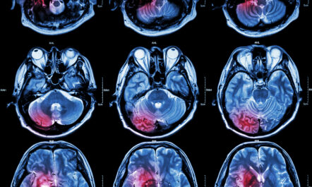 Neurosurgery and erectile dysfunction
